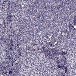 Invitrogen Growth Hormone Receptor Polyclonal Antibody 100 &mu;L; Unconjugated:Antibodies,