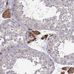 Invitrogen Growth Hormone Receptor Polyclonal Antibody 100 &mu;L; Unconjugated:Antibodies,