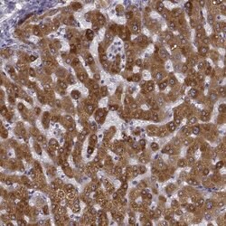 Invitrogen Growth Hormone Receptor Polyclonal Antibody 100 &mu;L; Unconjugated:Antibodies,