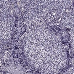 Invitrogen Growth Hormone Receptor Polyclonal Antibody 100 &mu;L; Unconjugated:Antibodies,