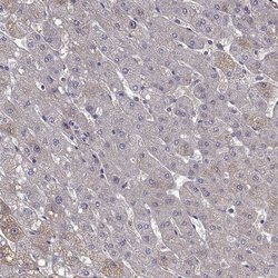 Invitrogen Tomosyn Polyclonal Antibody 100 &mu;L; Unconjugated:Antibodies,
