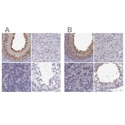 Invitrogen GPR64 Polyclonal Antibody 100 &mu;L; Unconjugated:Antibodies,