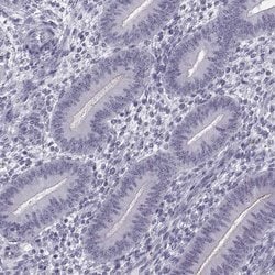 Invitrogen GPR64 Polyclonal Antibody 100 &mu;L; Unconjugated:Antibodies,