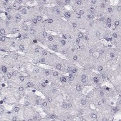 Invitrogen GPR64 Polyclonal Antibody 100 &mu;L; Unconjugated:Antibodies,