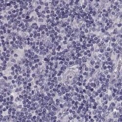 Invitrogen GPR64 Polyclonal Antibody 100 &mu;L; Unconjugated:Antibodies,