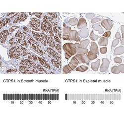 Invitrogen CTPS Polyclonal Antibody 100 &mu;L; Unconjugated:Antibodies,