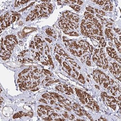Invitrogen CTPS Polyclonal Antibody 100 &mu;L; Unconjugated:Antibodies,