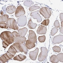 Invitrogen CTPS Polyclonal Antibody 100 &mu;L; Unconjugated:Antibodies,