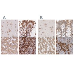 Invitrogen Ribophorin I Polyclonal Antibody 100 &mu;L; Unconjugated:Antibodies,