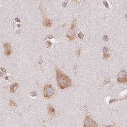 Invitrogen Ribophorin I Polyclonal Antibody 100 &mu;L; Unconjugated:Antibodies,
