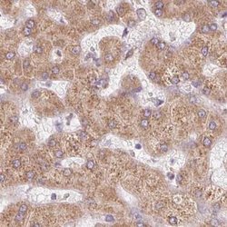 Invitrogen Ribophorin I Polyclonal Antibody 100 &mu;L; Unconjugated:Antibodies,