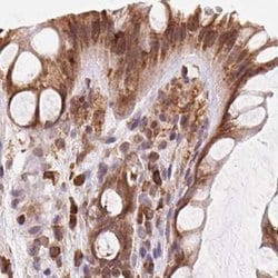 Invitrogen Ribophorin I Polyclonal Antibody 100 &mu;L; Unconjugated:Antibodies,