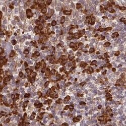 Invitrogen Ribophorin I Polyclonal Antibody 100 &mu;L; Unconjugated:Antibodies,