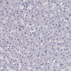 Invitrogen QRICH2 Polyclonal Antibody 100 &mu;L; Unconjugated:Antibodies,