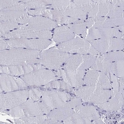 Invitrogen QRICH2 Polyclonal Antibody 100 &mu;L; Unconjugated:Antibodies,