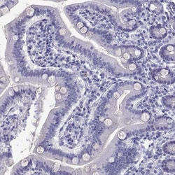 Invitrogen QRICH2 Polyclonal Antibody 100 &mu;L; Unconjugated:Antibodies,