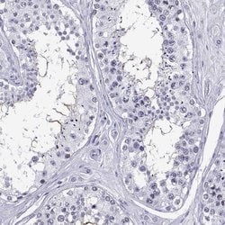 Invitrogen QRICH2 Polyclonal Antibody 100 &mu;L; Unconjugated:Antibodies,