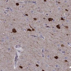 Invitrogen PCP4L1 Polyclonal Antibody 100 &mu;L; Unconjugated:Antibodies,