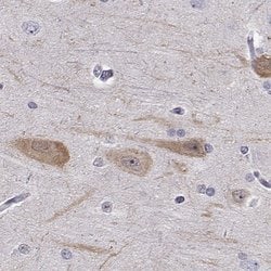 Invitrogen PCP4L1 Polyclonal Antibody 100 &mu;L; Unconjugated:Antibodies,