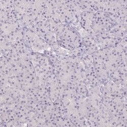 Invitrogen PNMAL2 Polyclonal Antibody 100 &mu;L; Unconjugated:Antibodies,