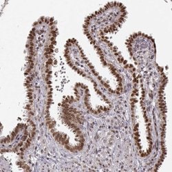 Invitrogen RAI1 Polyclonal Antibody 100 &mu;L | Buy Online | Invitrogen&trade; | Fisher Scientific