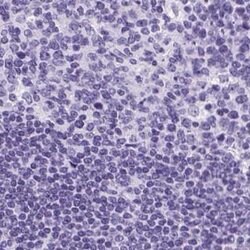 Invitrogen Cytokeratin 12 Polyclonal Antibody 100 &mu;L; Unconjugated:Antibodies,