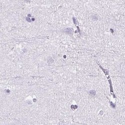 Invitrogen Cytokeratin 12 Polyclonal Antibody 100 &mu;L; Unconjugated:Antibodies,