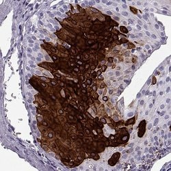 Invitrogen Cytokeratin 12 Polyclonal Antibody 100 &mu;L; Unconjugated:Antibodies,