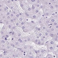 Invitrogen Cytokeratin 12 Polyclonal Antibody 100 &mu;L; Unconjugated:Antibodies,