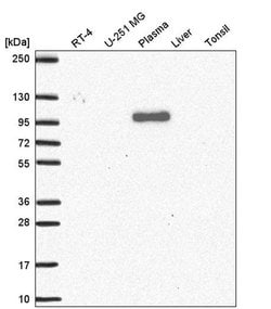 Invitrogen QSOX1 Polyclonal Antibody 100 &mu;L; Unconjugated:Antibodies,