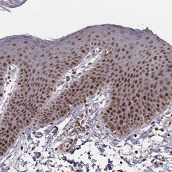 Invitrogen VRK3 Polyclonal Antibody 100 &mu;L | Buy Online | Invitrogen&trade; | Fisher Scientific