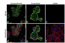 Invitrogen PALB2 Polyclonal Antibody 100 &mu;L | Buy Online | Invitrogen&trade; | Fisher Scientific
