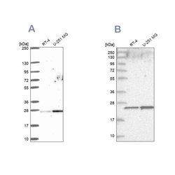 Invitrogen NOP16 Polyclonal Antibody 100 &mu;L | Buy Online | Invitrogen&trade; | Fisher Scientific
