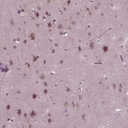 Invitrogen PORCN Polyclonal Antibody 100 &mu;L; Unconjugated:Antibodies,
