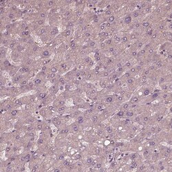 Invitrogen PORCN Polyclonal Antibody 100 &mu;L; Unconjugated:Antibodies,