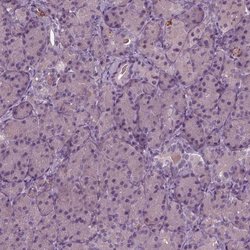 Invitrogen PORCN Polyclonal Antibody 100 &mu;L; Unconjugated:Antibodies,