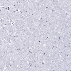 Invitrogen UAP56 Polyclonal Antibody 100 &mu;L; Unconjugated:Antibodies,