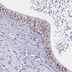 Invitrogen UAP56 Polyclonal Antibody 100 &mu;L; Unconjugated:Antibodies,