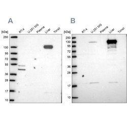 Invitrogen Pyruvate Carboxylase Polyclonal Antibody 100 &mu;L; Unconjugated:Antibodies,