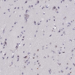 Invitrogen KRTAP2-4 Polyclonal Antibody 100 &mu;L | Buy Online | Invitrogen&trade; | Fisher Scientific