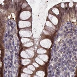 Invitrogen GSS Polyclonal Antibody 100 &mu;L; Unconjugated:Antibodies,
