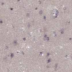 Invitrogen GSS Polyclonal Antibody 100 &mu;L; Unconjugated:Antibodies,
