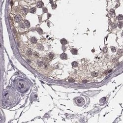 Invitrogen GSS Polyclonal Antibody 100 &mu;L; Unconjugated:Antibodies,