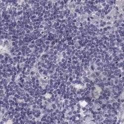 Invitrogen GRK1 Polyclonal Antibody 100 &mu;L | Buy Online | Invitrogen&trade; | Fisher Scientific