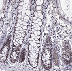 Invitrogen HNRNPA0 Polyclonal Antibody 100 &mu;L; Unconjugated:Antibodies,