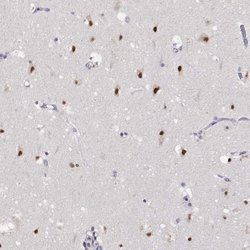 Invitrogen HNRNPA0 Polyclonal Antibody 100 &mu;L; Unconjugated:Antibodies,