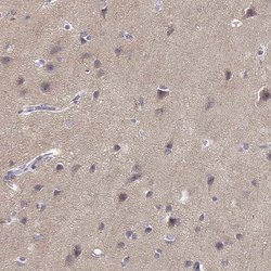 TMEM145 Polyclonal Antibody:Antibodies, Polyclonal