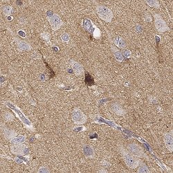 TMEM145 Polyclonal Antibody:Antibodies, Polyclonal