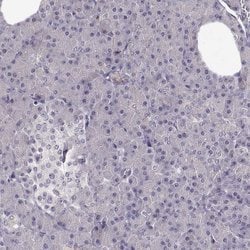 TMEM145 Polyclonal Antibody:Antibodies, Polyclonal