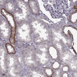 Invitrogen CCDC64 Polyclonal Antibody 100 &mu;L; Unconjugated:Antibodies,